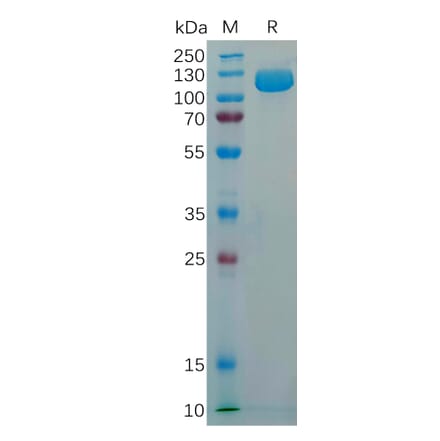 SDS-PAGE - Recombinant Human NCAM1 Protein (6×His Tag) (A318294) - Antibodies.com