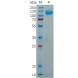 SDS-PAGE - Recombinant Human NCAM1 Protein (6×His Tag) (A318294) - Antibodies.com