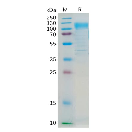SDS-PAGE - Recombinant Human CD36 Protein (Fc Tag) (A318296) - Antibodies.com