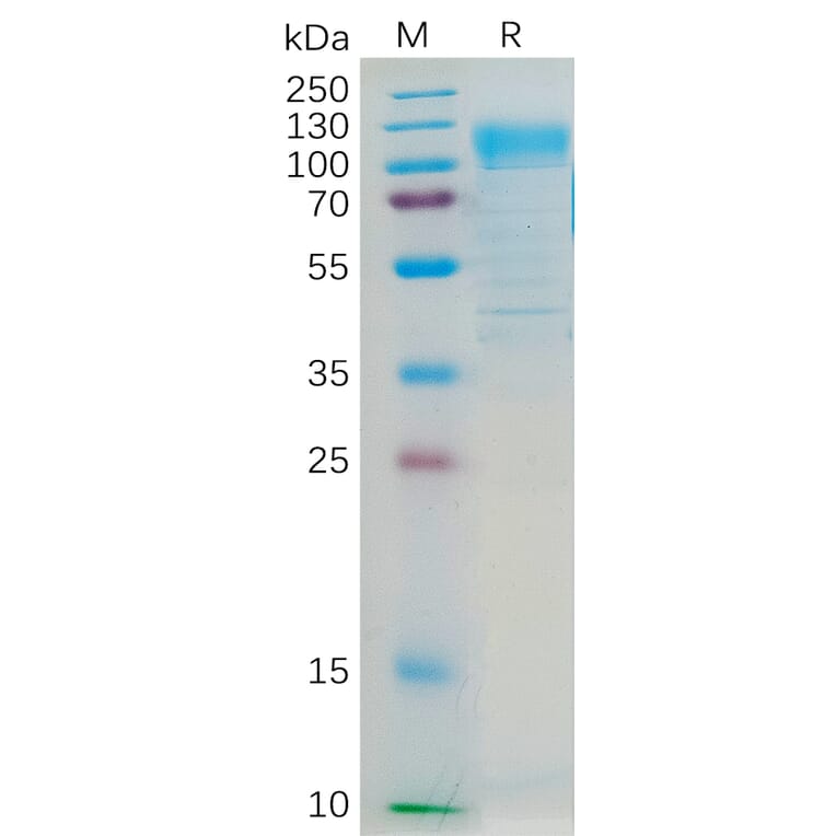 SDS-PAGE - Recombinant Human CD36 Protein (Fc Tag) (A318296) - Antibodies.com