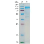 SDS-PAGE - Recombinant Human CD36 Protein (Fc Tag) (A318296) - Antibodies.com