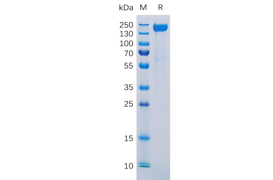 SDS-PAGE - Recombinant Human L1CAM Protein (6×His Tag) (A318297) - Antibodies.com