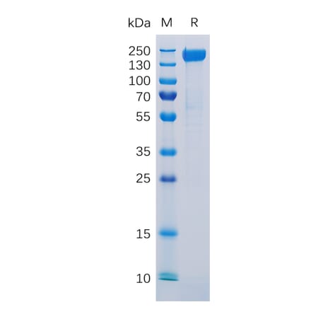 SDS-PAGE - Recombinant Human L1CAM Protein (6×His Tag) (A318297) - Antibodies.com