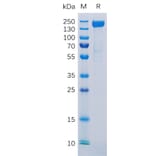 SDS-PAGE - Recombinant Human L1CAM Protein (6×His Tag) (A318297) - Antibodies.com