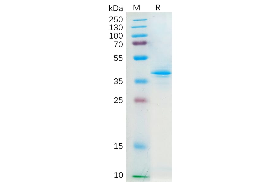 SDS-PAGE - Recombinant Human Macrophage Inflammatory Protein 3 alpha Protein (Fc Tag) (A318298) - Antibodies.com