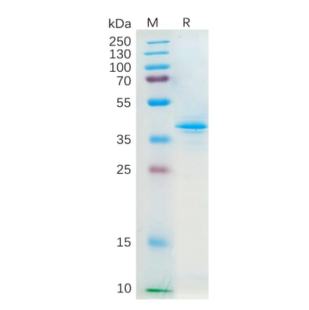 SDS-PAGE - Recombinant Human Macrophage Inflammatory Protein 3 alpha Protein (Fc Tag) (A318298) - Antibodies.com