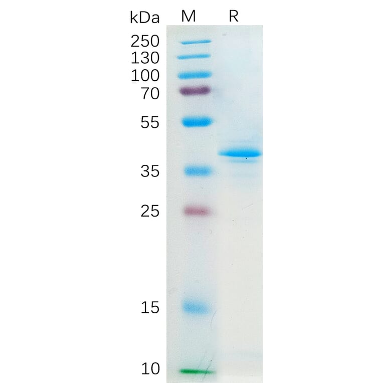 SDS-PAGE - Recombinant Human Macrophage Inflammatory Protein 3 alpha Protein (Fc Tag) (A318298) - Antibodies.com