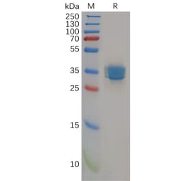 SDS-PAGE - Recombinant Human Cannabinoid Receptor II Protein (Fc Tag) (A318299) - Antibodies.com