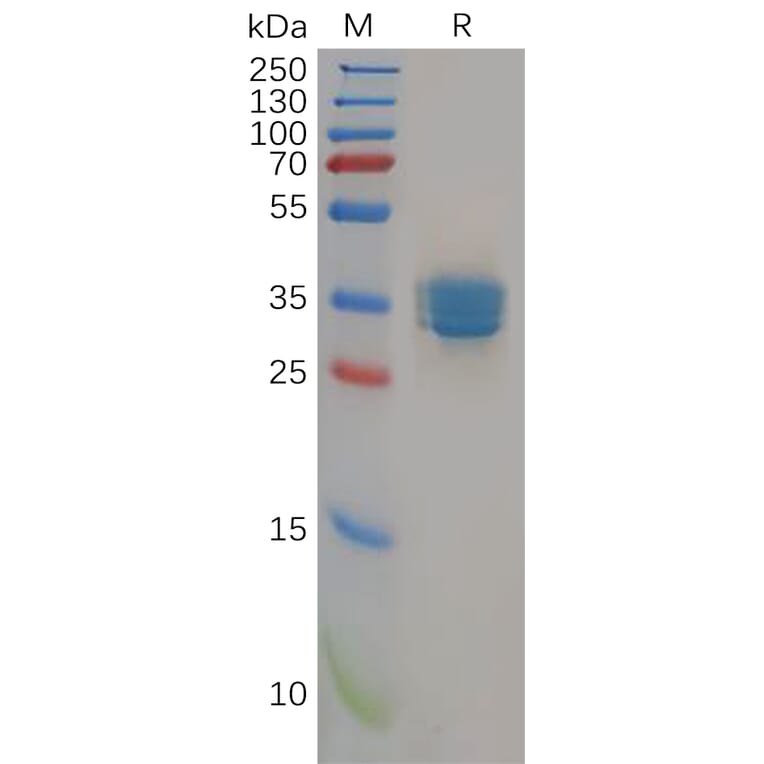 SDS-PAGE - Recombinant Human Cannabinoid Receptor II Protein (Fc Tag) (A318299) - Antibodies.com