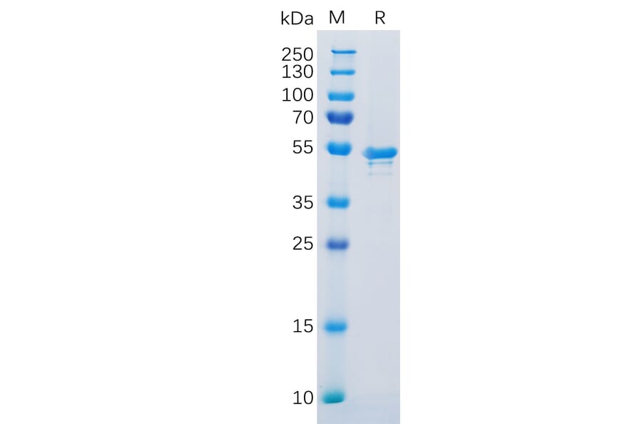 SDS-PAGE - Recombinant Human Carbonic Anhydrase 9/CA9 Protein (6×His Tag) (A318300) - Antibodies.com