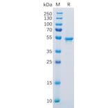SDS-PAGE - Recombinant Human Carbonic Anhydrase 9/CA9 Protein (6×His Tag) (A318300) - Antibodies.com