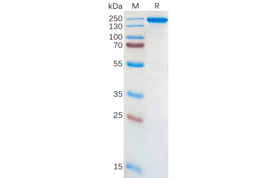 SDS-PAGE - Recombinant Human ALK Protein (Fc Tag) (A318301) - Antibodies.com