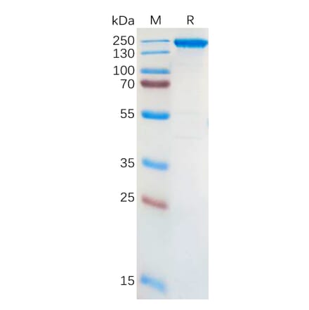 SDS-PAGE - Recombinant Human ALK Protein (Fc Tag) (A318301) - Antibodies.com