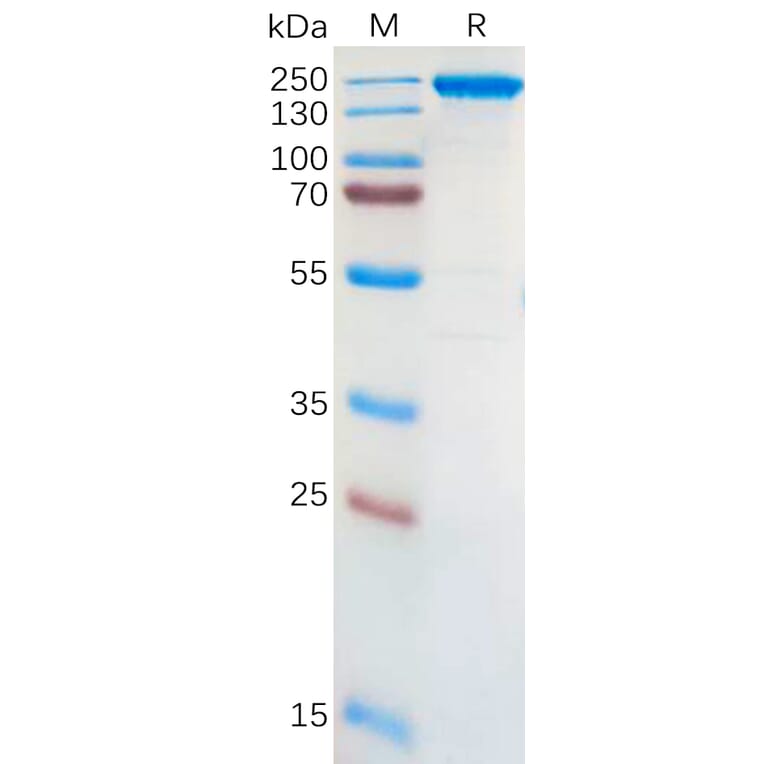 SDS-PAGE - Recombinant Human ALK Protein (Fc Tag) (A318301) - Antibodies.com
