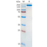 SDS-PAGE - Recombinant Human ALK Protein (Fc Tag) (A318301) - Antibodies.com