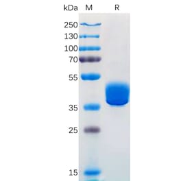SDS-PAGE - Recombinant Human Adenosine Receptor A2a Protein (Fc Tag) (A318302) - Antibodies.com