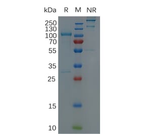 SDS-PAGE - Recombinant Human ADAM9 Protein (Fc Tag) (A318303) - Antibodies.com