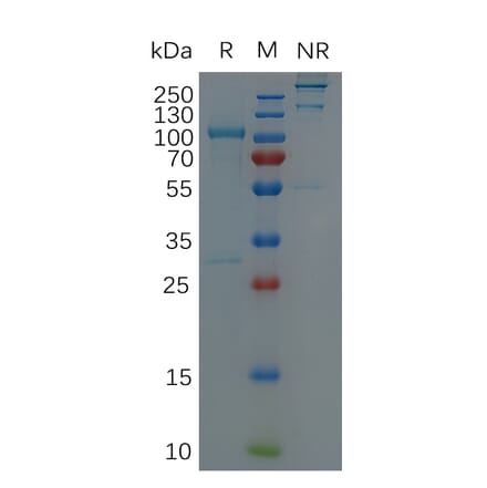 SDS-PAGE - Recombinant Human ADAM9 Protein (Fc Tag) (A318303) - Antibodies.com