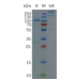 SDS-PAGE - Recombinant Human ADAM9 Protein (Fc Tag) (A318303) - Antibodies.com