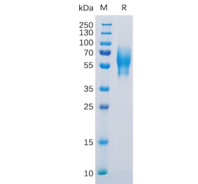 SDS-PAGE - Recombinant Human 5T4 Protein (6×His Tag) (A318304) - Antibodies.com