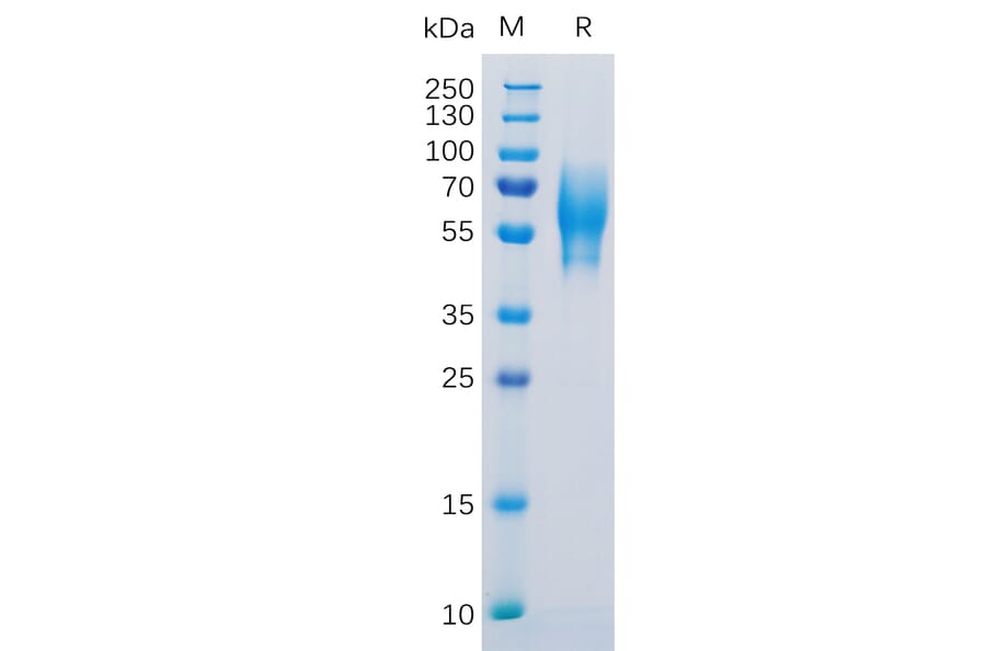 SDS-PAGE - Recombinant Human 5T4 Protein (6×His Tag) (A318304) - Antibodies.com