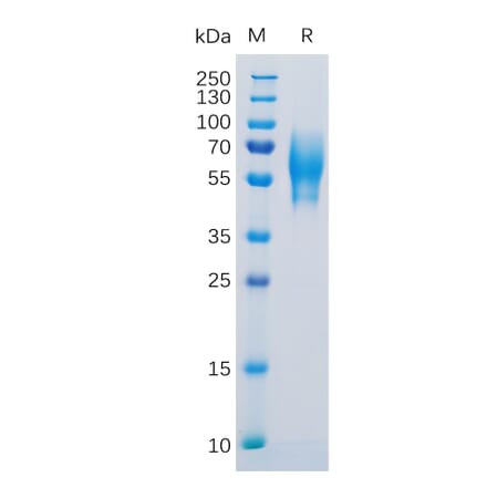 SDS-PAGE - Recombinant Human 5T4 Protein (6×His Tag) (A318304) - Antibodies.com