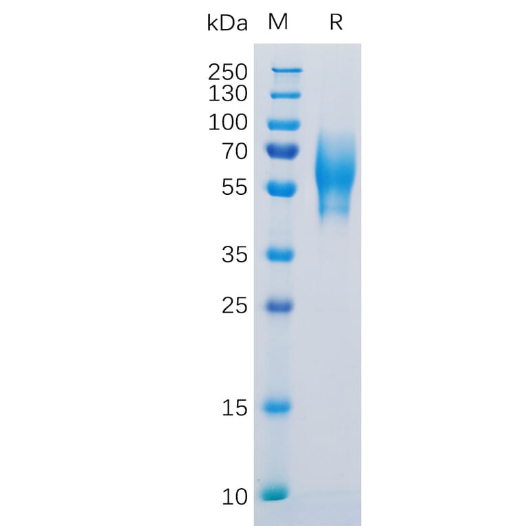 SDS-PAGE - Recombinant Human 5T4 Protein (6×His Tag) (A318304) - Antibodies.com