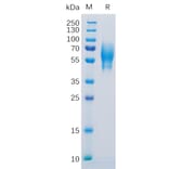 SDS-PAGE - Recombinant Human 5T4 Protein (6×His Tag) (A318304) - Antibodies.com