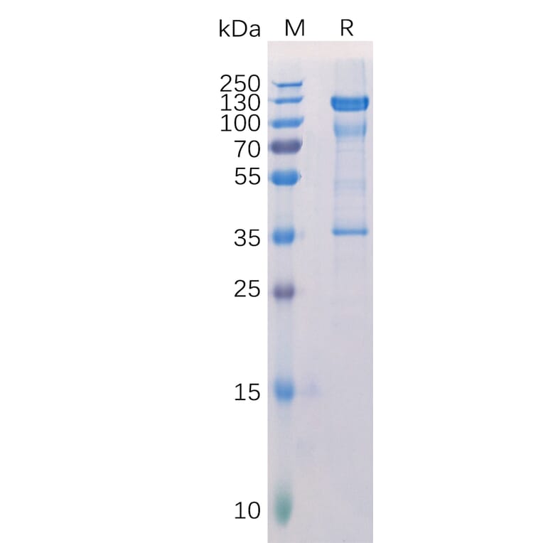 SDS-PAGE - Recombinant Human Melanoma gp100 Protein (Fc Tag) (A318305) - Antibodies.com