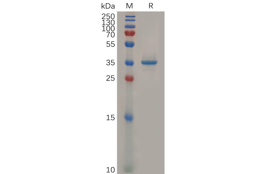 SDS-PAGE - Recombinant Human Glypican 3 Protein (Fc Tag) (A318306) - Antibodies.com