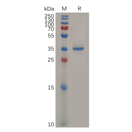 SDS-PAGE - Recombinant Human Glypican 3 Protein (Fc Tag) (A318306) - Antibodies.com
