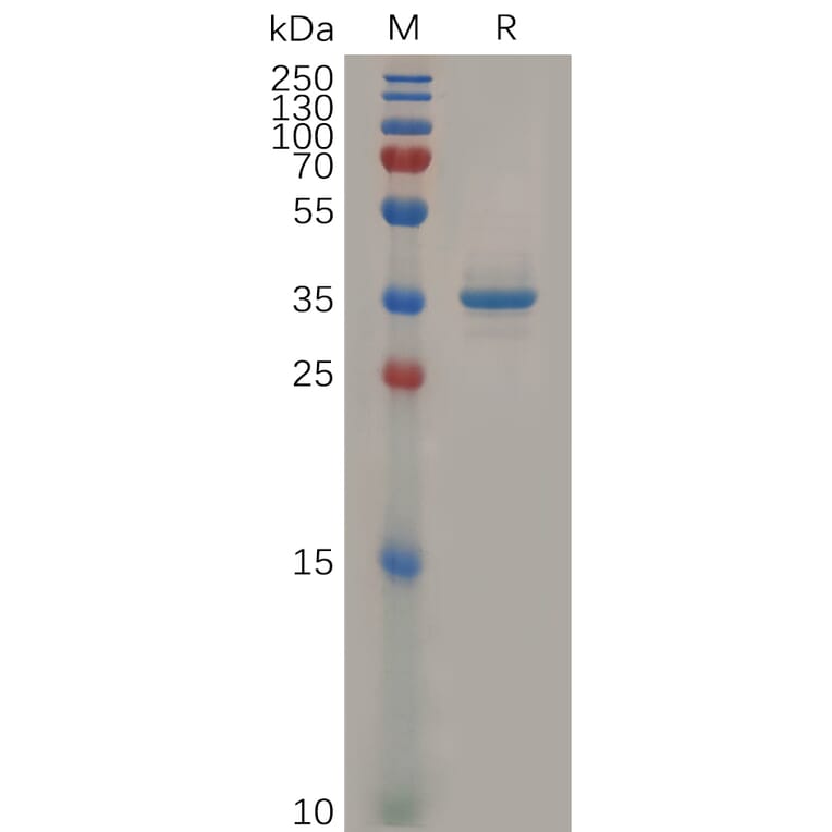 SDS-PAGE - Recombinant Human Glypican 3 Protein (Fc Tag) (A318306) - Antibodies.com