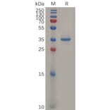 SDS-PAGE - Recombinant Human Glypican 3 Protein (Fc Tag) (A318306) - Antibodies.com