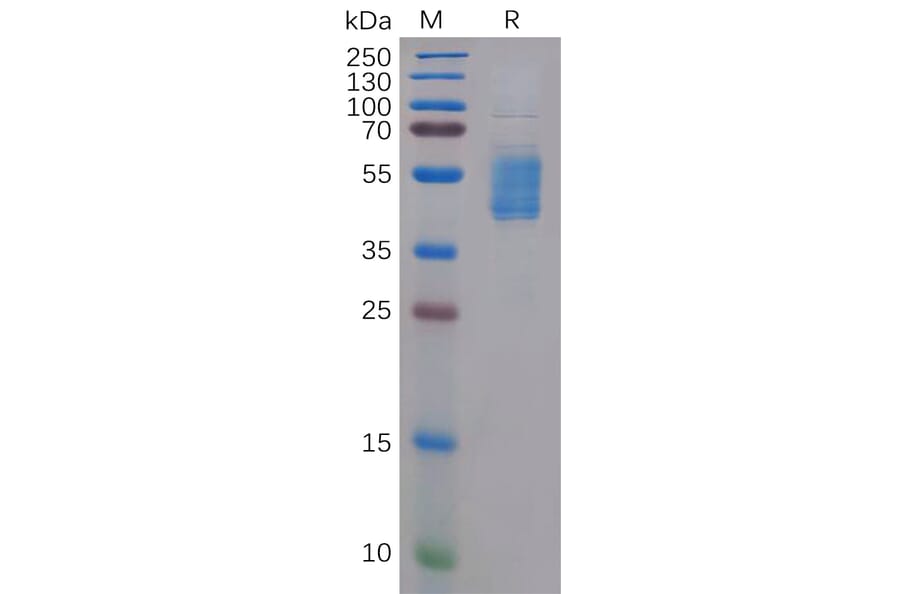 SDS-PAGE - Recombinant Human CCR4 Protein (Fc Tag) (A318307) - Antibodies.com