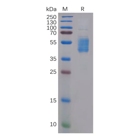 SDS-PAGE - Recombinant Human CCR4 Protein (Fc Tag) (A318307) - Antibodies.com