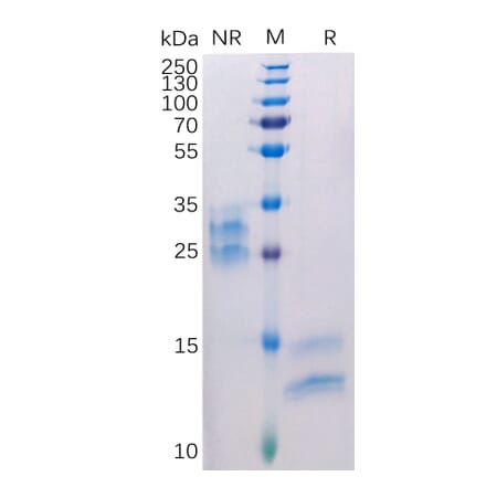 SDS-PAGE - Recombinant Human VEGFA Protein (6×His Tag) (A318308) - Antibodies.com