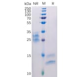 SDS-PAGE - Recombinant Human VEGFA Protein (6×His Tag) (A318308) - Antibodies.com