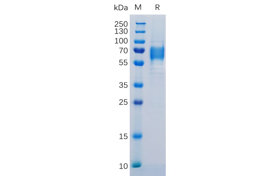 SDS-PAGE - Recombinant Human IL-6R Protein (6×His Tag) (A318309) - Antibodies.com