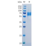 SDS-PAGE - Recombinant Human IL-6R Protein (6×His Tag) (A318309) - Antibodies.com