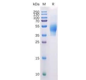SDS-PAGE - Recombinant Human CD44 Protein (6×His Tag) (A318310) - Antibodies.com
