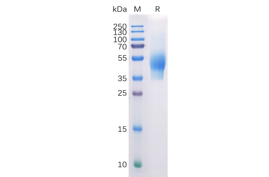 SDS-PAGE - Recombinant Human CD44 Protein (6×His Tag) (A318310) - Antibodies.com