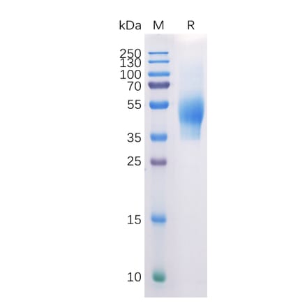 SDS-PAGE - Recombinant Human CD44 Protein (6×His Tag) (A318310) - Antibodies.com