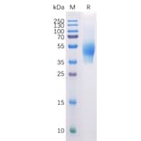 SDS-PAGE - Recombinant Human CD44 Protein (6×His Tag) (A318310) - Antibodies.com