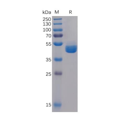 SDS-PAGE - Recombinant Human TIGIT Protein (Fc Tag) (A318311) - Antibodies.com