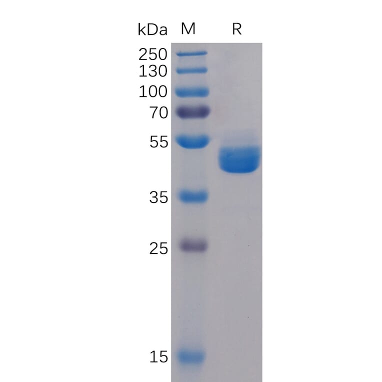 SDS-PAGE - Recombinant Human TIGIT Protein (Fc Tag) (A318311) - Antibodies.com