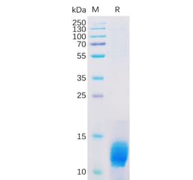 SDS-PAGE - Recombinant Human MUC1 Protein (6×His Tag) (A318312) - Antibodies.com