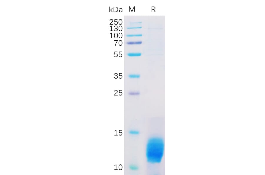 SDS-PAGE - Recombinant Human MUC1 Protein (6×His Tag) (A318312) - Antibodies.com