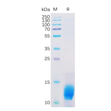 SDS-PAGE - Recombinant Human MUC1 Protein (6×His Tag) (A318312) - Antibodies.com