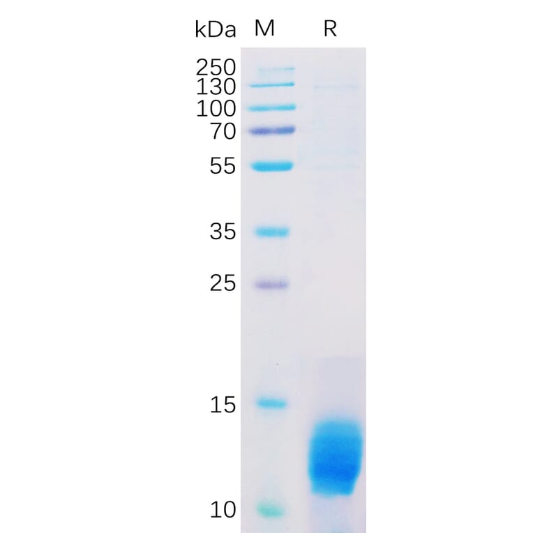 SDS-PAGE - Recombinant Human MUC1 Protein (6×His Tag) (A318312) - Antibodies.com