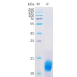 SDS-PAGE - Recombinant Human MUC1 Protein (6×His Tag) (A318312) - Antibodies.com